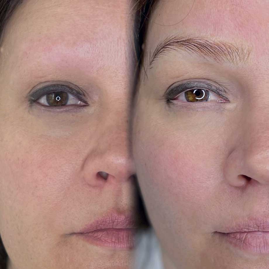 Alopecia Brow Tattoo