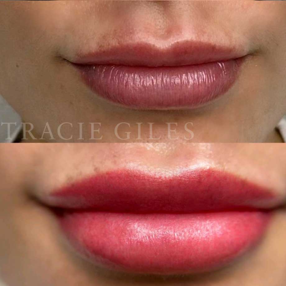 Melanin-Rich Lips Correction