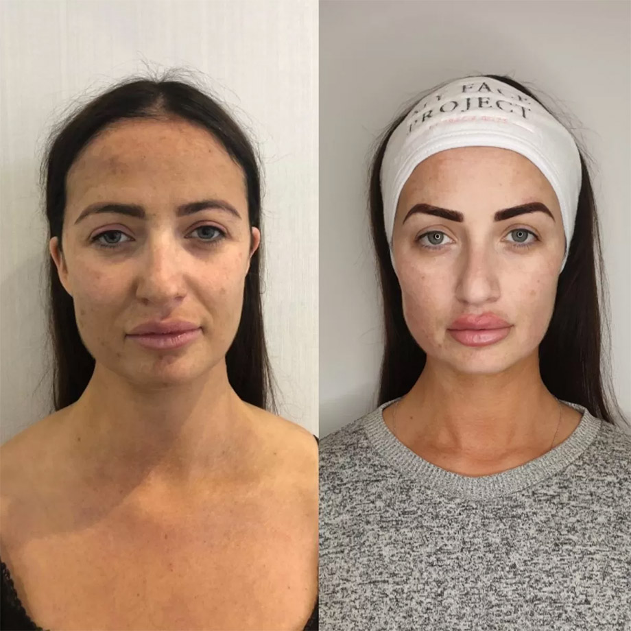Chantelle Houghton My Face Project