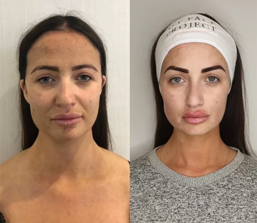 Chantelle Houghton’s before and after