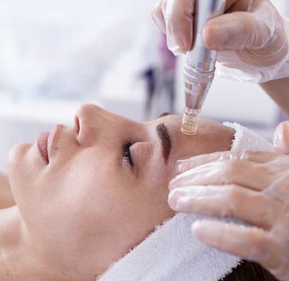 Microneedling