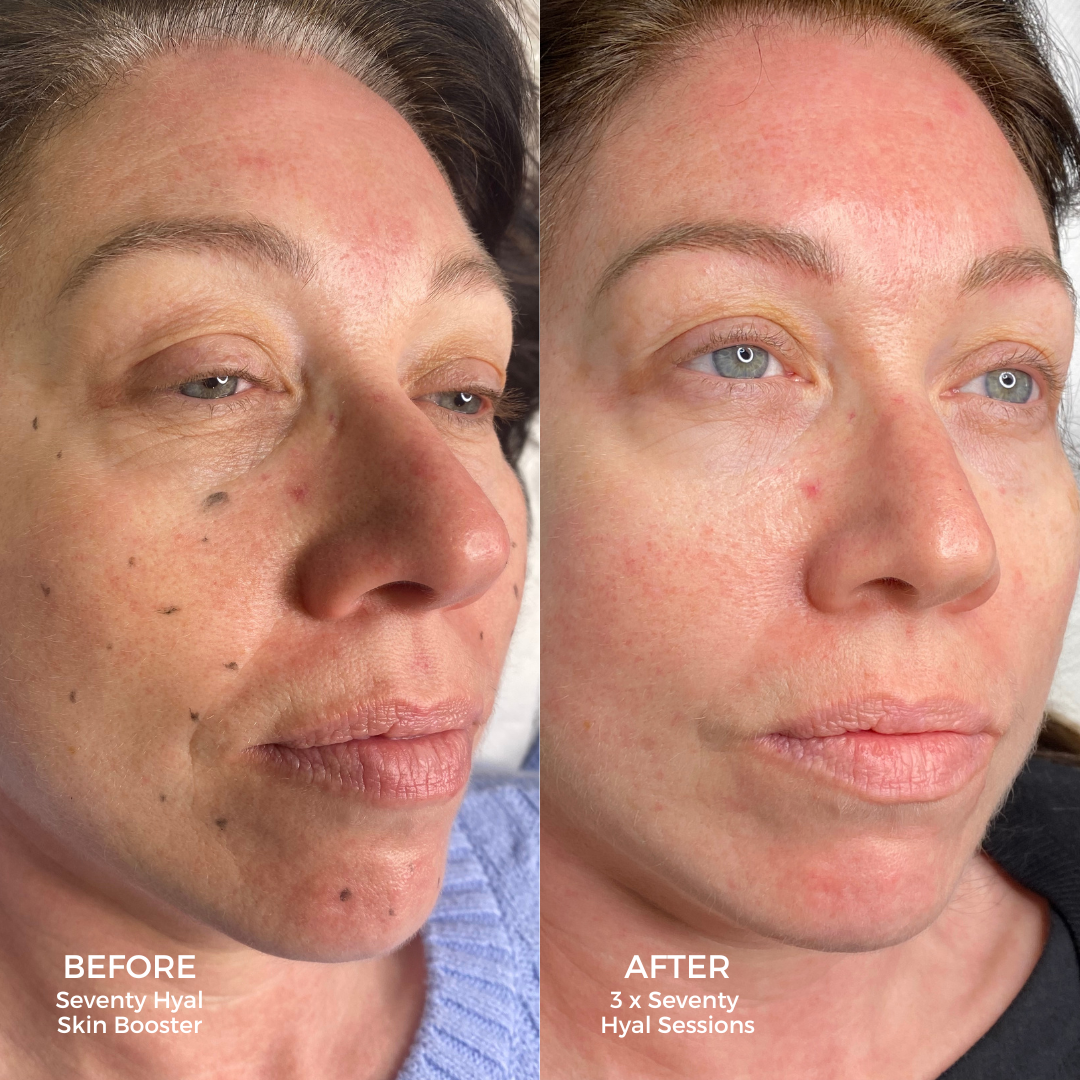 Rejuvenate Your Post-Summer Glow at Tracie Giles London