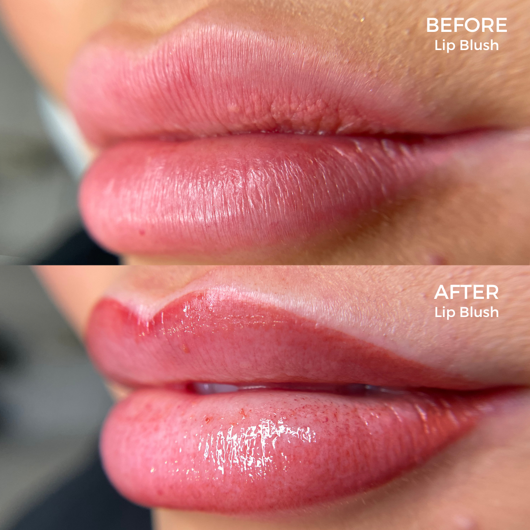 Rejuvenate Your Post-Summer Glow at Tracie Giles London