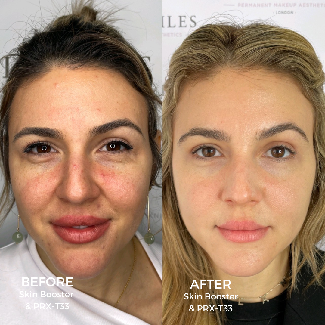 Rejuvenate Your Post-Summer Glow at Tracie Giles London
